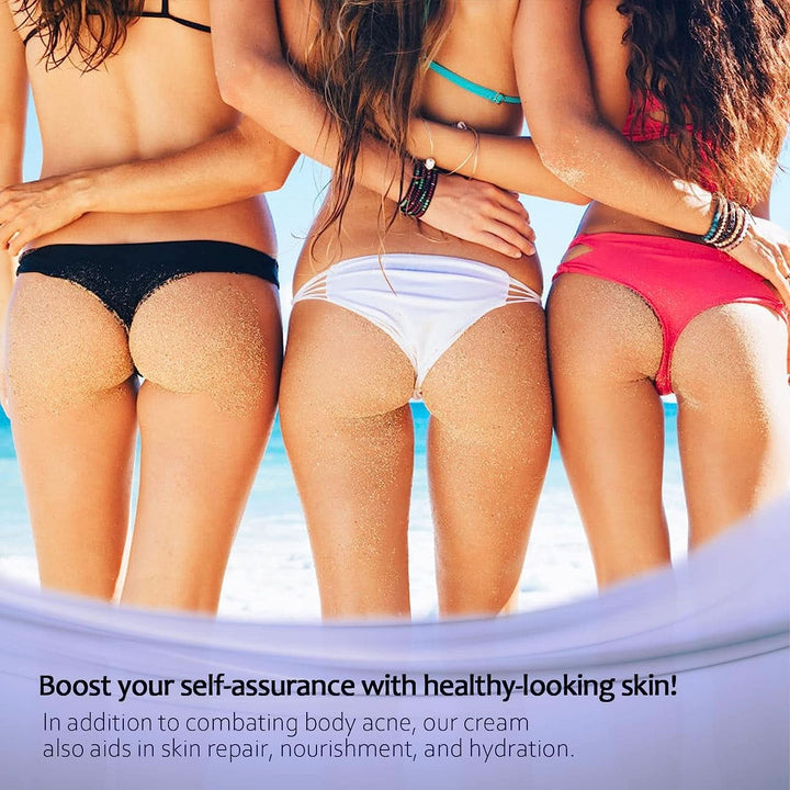 Cremă împotriva acneei, 100 ml Cosmetice si Infrumusetare Naty Shop