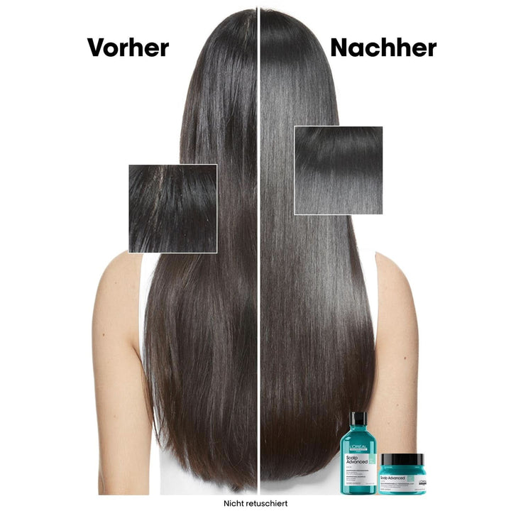 L'Oréal Professionnel Șampon de păr pentru curățarea scalpului gras, 300 ml Duș și baie Naty Shop